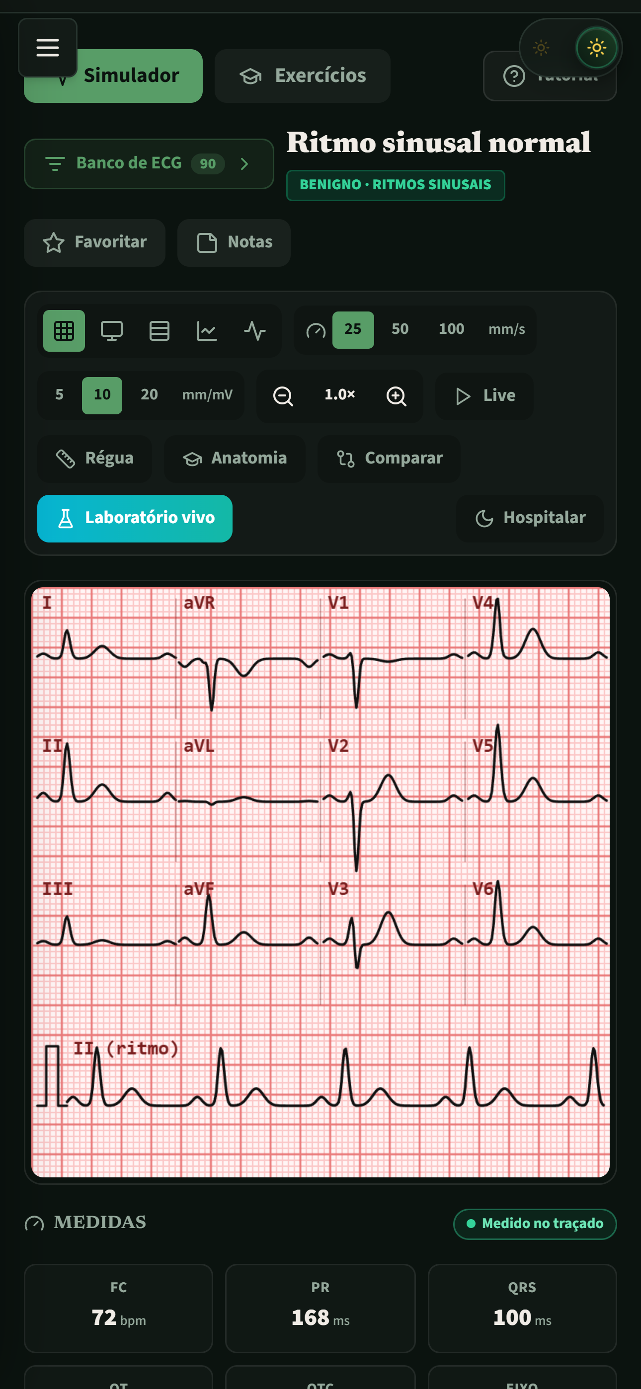 Simulador de ECG — 12 derivações em papel milimetrado